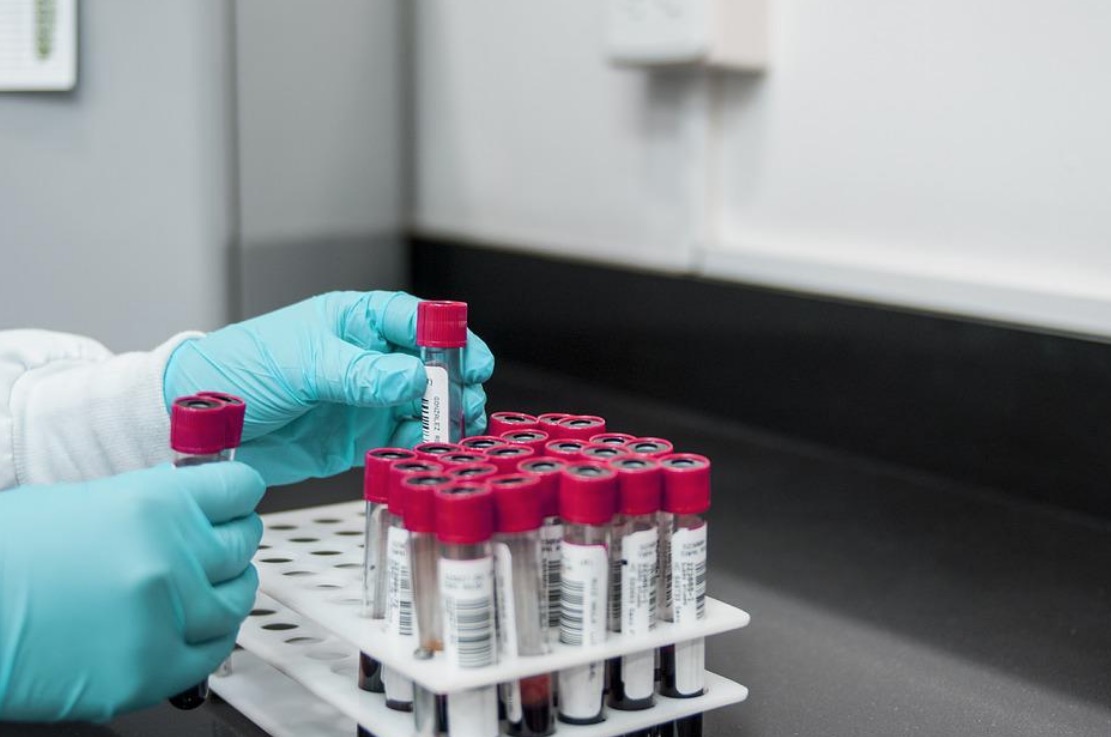 Homem assume criança após erro em teste de DNA e acaba indenizado após reviravolta 