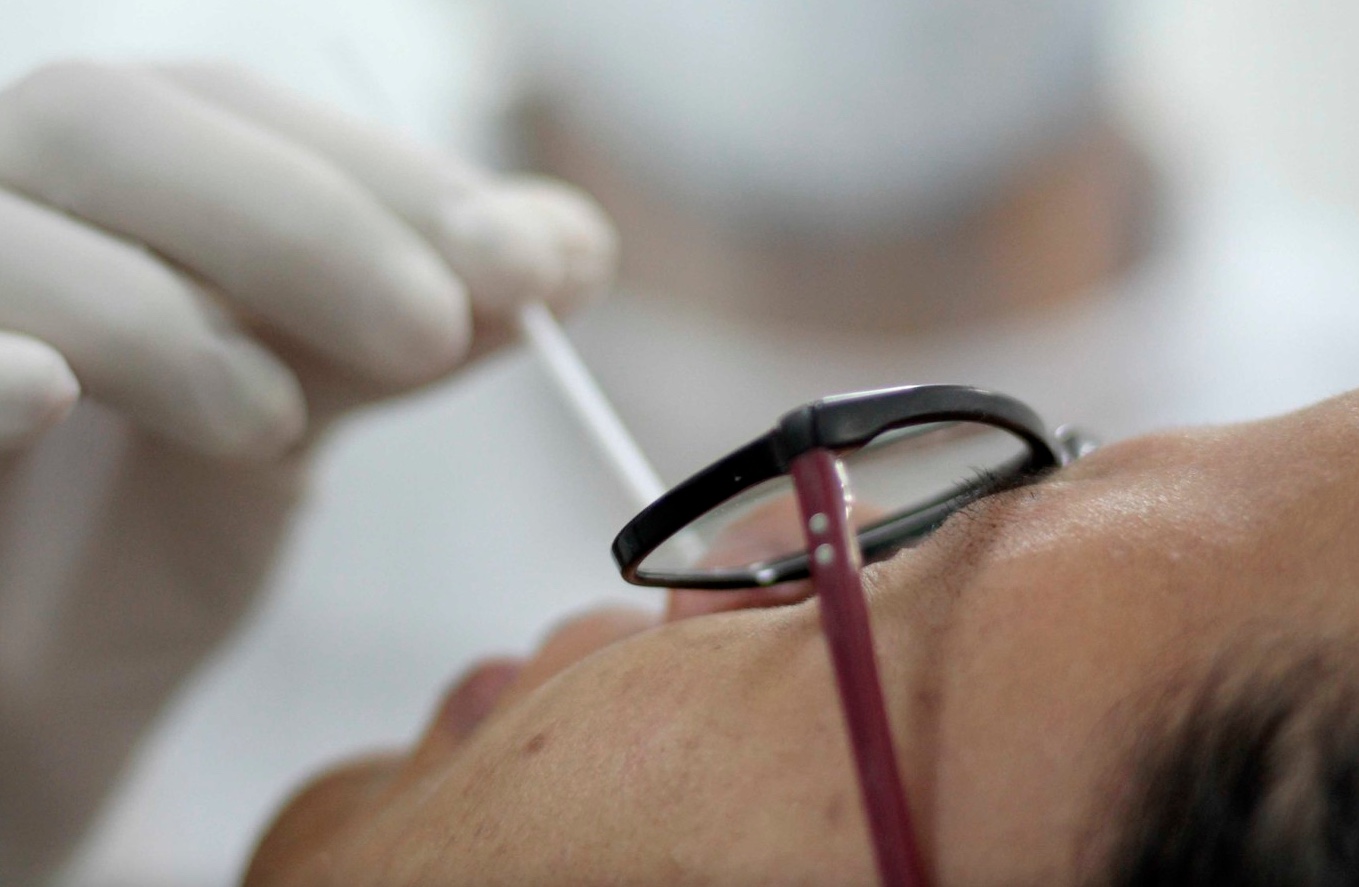 Fiocruz Amazônia faz testes PCR para diagnosticar casos de Varíola dos Macacos em 24h