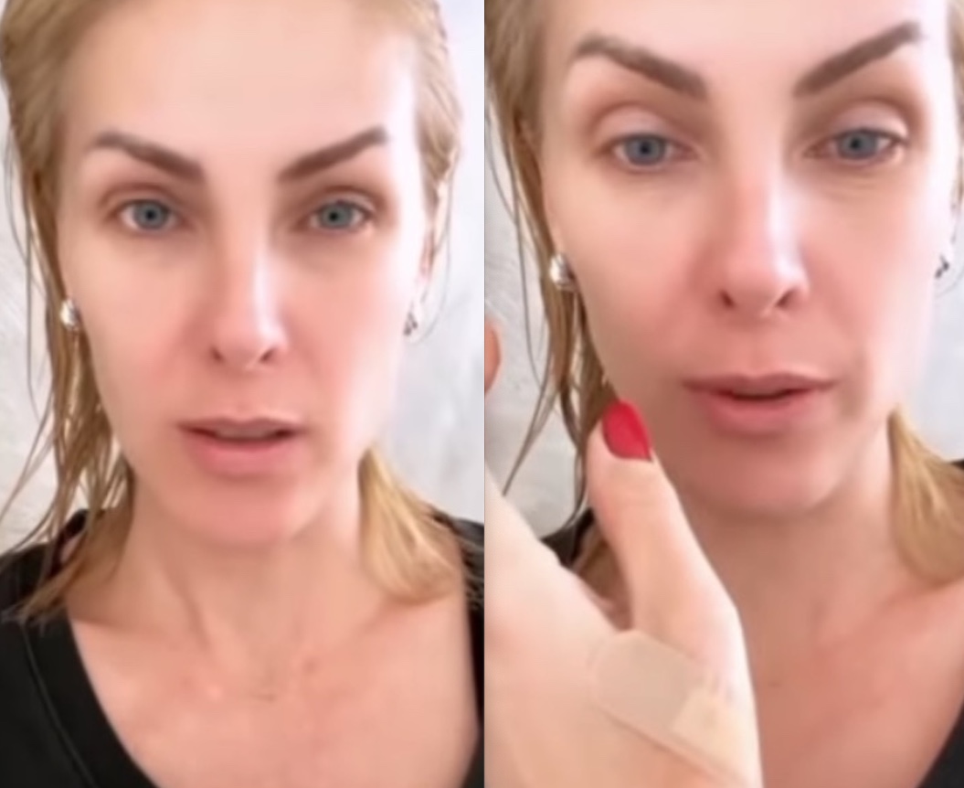 Ana Hickmann sofre acidente no banheiro: ‘cortado meu corpo inteiro’ 