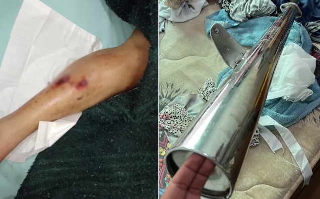 Homem tenta matar esposa com escapamento de moto e queima filho com mingau quente