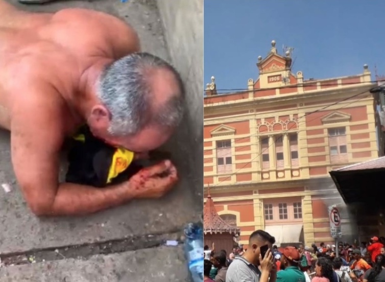 Homem que ateou fogo no Mercado Adolpho Lisboa é internado em estado grave em Manaus