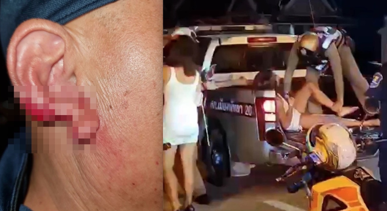 Prostituta bêbada invade ônibus turístico e arranca pedaço da orelha de homem