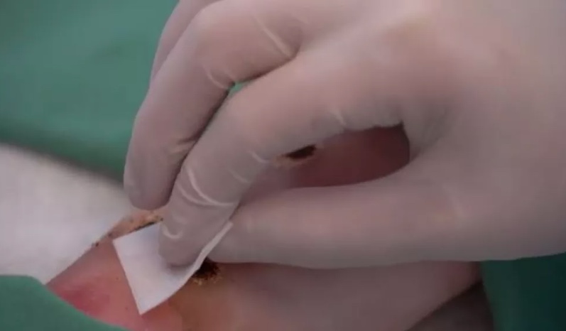 Sobe para 16 o número de casos de varíola dos macacos no Amazonas