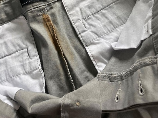 Loja online envia bermuda 'freada' de cocô para cliente