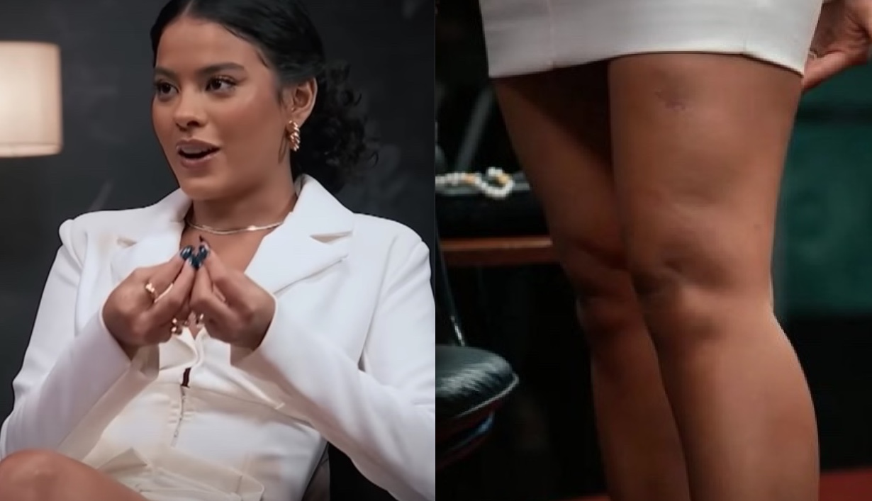 Bella Campos, a Muda de Pantanal, tem perna abocanhada por jacaré durante gravações