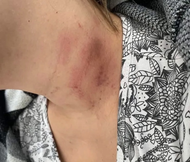 Mulher é espancada por namorado ao ser flagrada dançando com amiga em boate