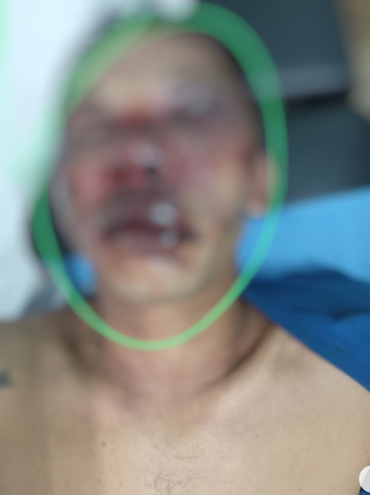 Homem mata 'amigo de copo' durante bebedeira no Amazonas