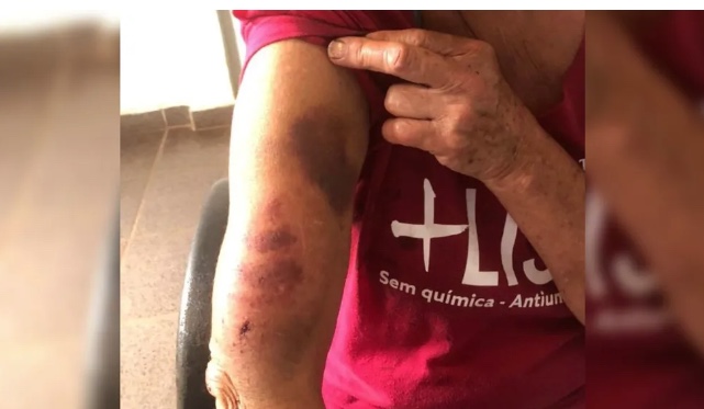 Polícia salva mulher torturada e queimada com 1 litro de óleo quente pelo próprio marido