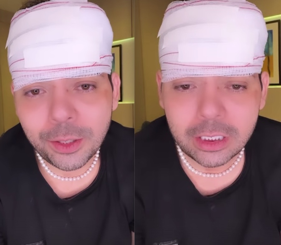 Humorista Gustavo Mendes leva pedrada na cabeça durante tentativa de assalto