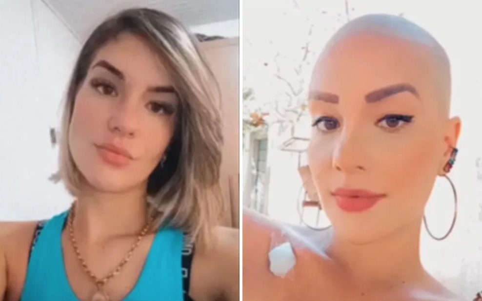 Mulher raspa o cabelo para fingir ter câncer e aplicar golpes com rifas e doações