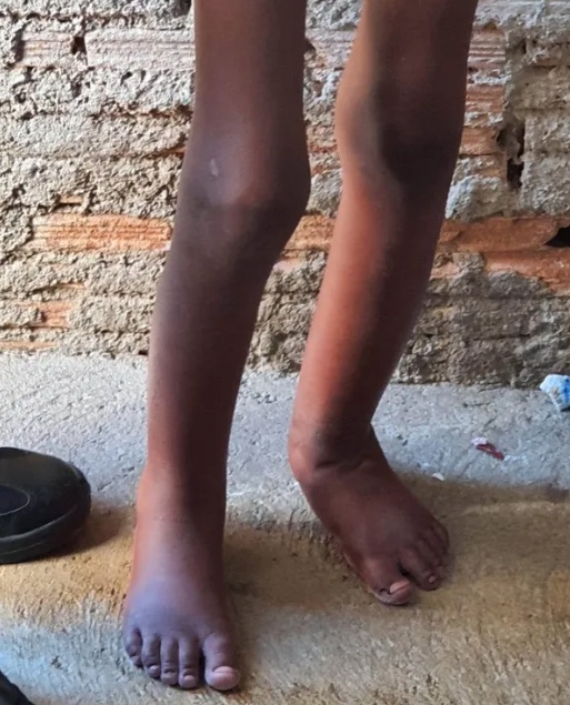 Menino aguarda adoção 2 anos após ser resgatado dentro de barril