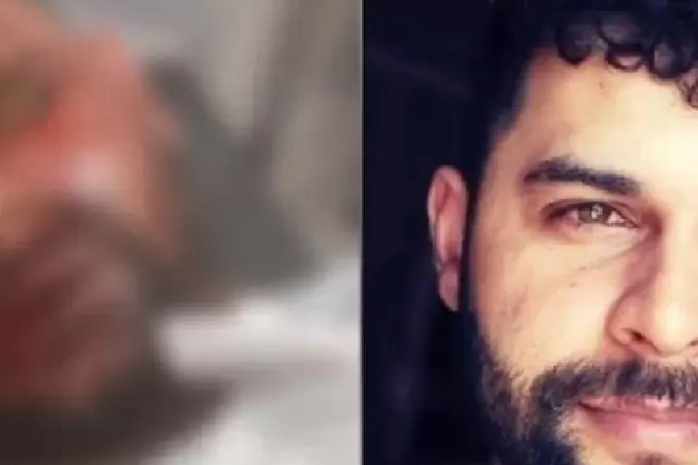 Tatuador fica cego após ex-namorada jogar soda cáustica em seu rosto