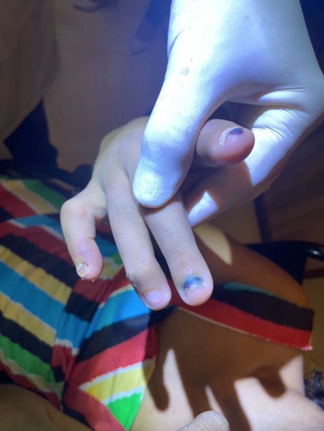 Cadeirante é resgatada após 4 anos sendo torturada pela irmã; vítima teve unhas arrancadas