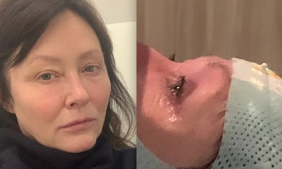 Shannen Doherty, de ‘Barrados no Baile’, diz que câncer se espalhou para o cérebro 
