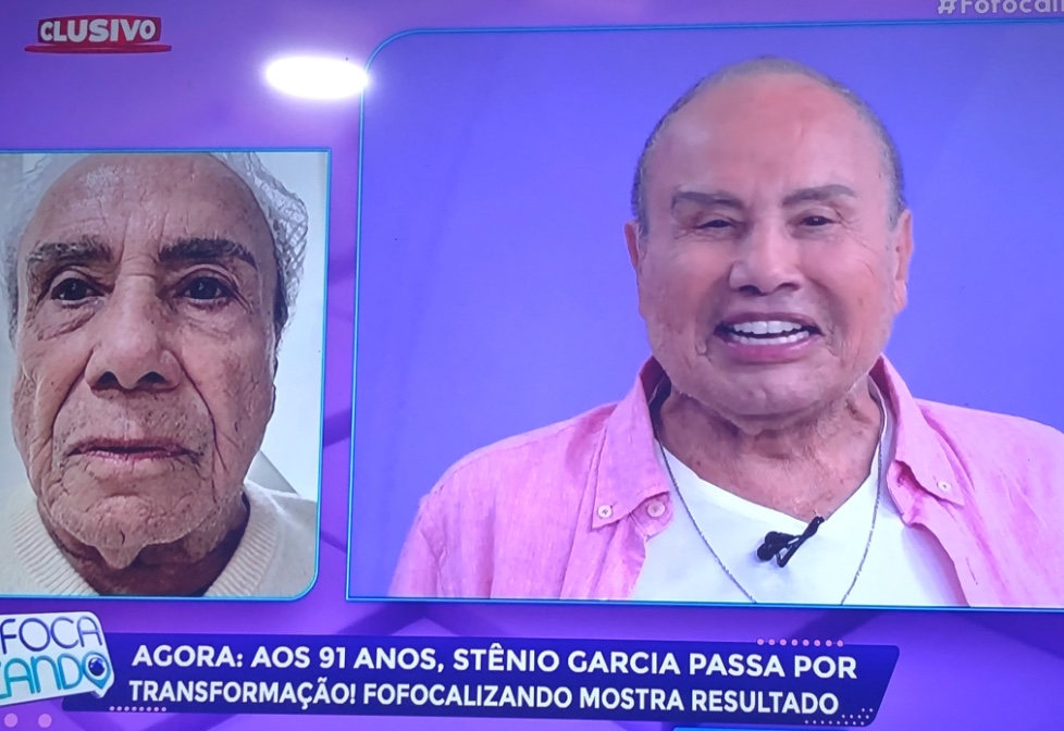 Stenio Garcia faz harmonização facial aos 91 anos e choca com resultado