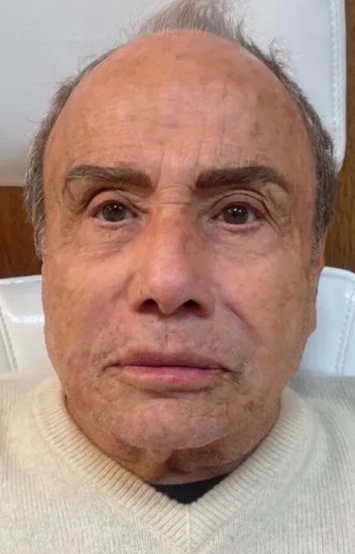 Esposa de Stenio Garcia cita harmonização ao falar sobre infecção generalizada do ator