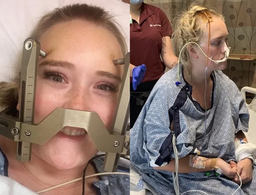 Aos 22 anos, jovem sofre AVC após bater a cabeça