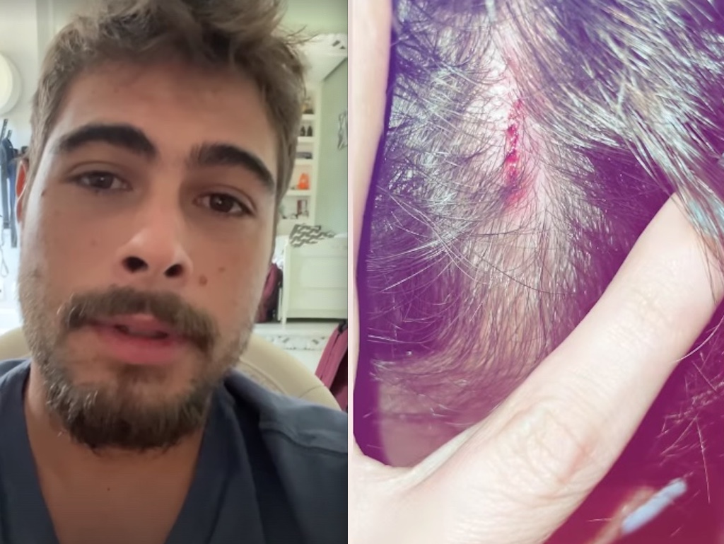 Ator Rafael Vitti sofre acidente ao surfar: 'mar estava grande'