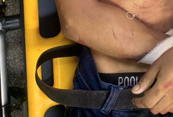 Homem morre após ser baleado em beco de Manaus