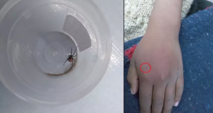 Criança é picada por viúva-negra e diz que queria virar o Homem-Aranha