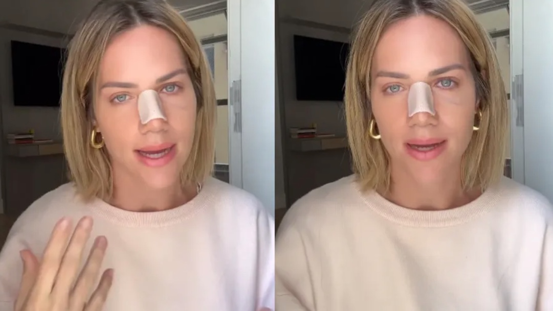 Gio Ewbank passa por cirurgia de desvio de septo e revela crises de ansiedade