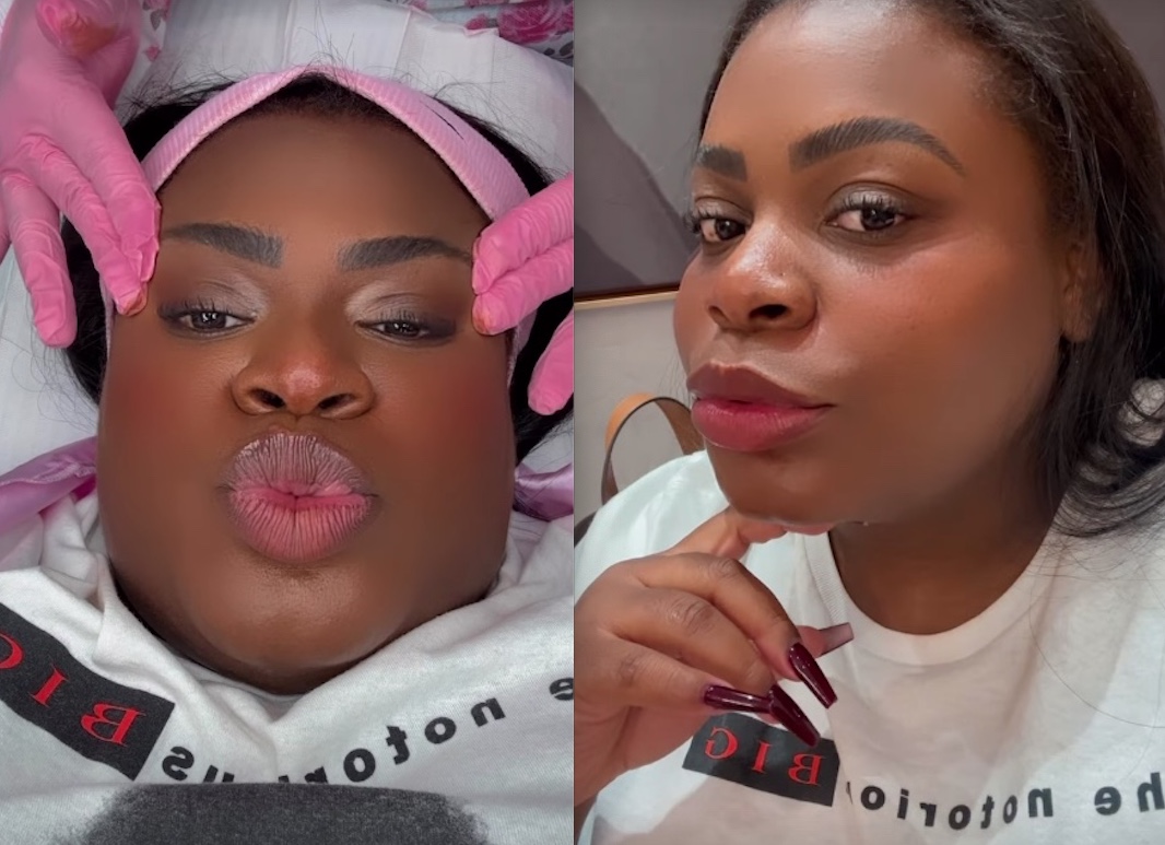 Jojo Todynho faz procedimento de R$ 8 mil nas sobrancelhas