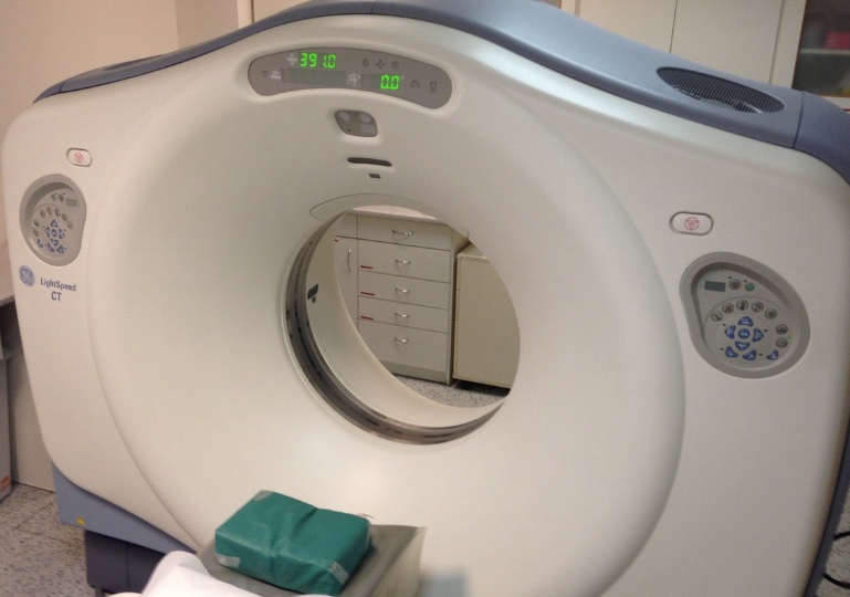 Idosa descobre que está com agulha no cérebro há 80 anos