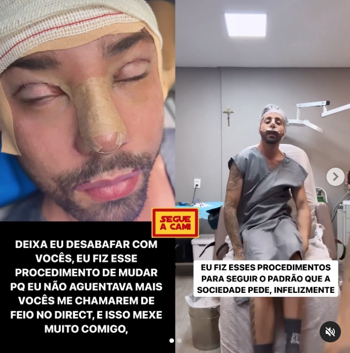 Rico Melquiades faz nova plástica e desabafa: 'não aguentava mais vocês me chamarem de feio'