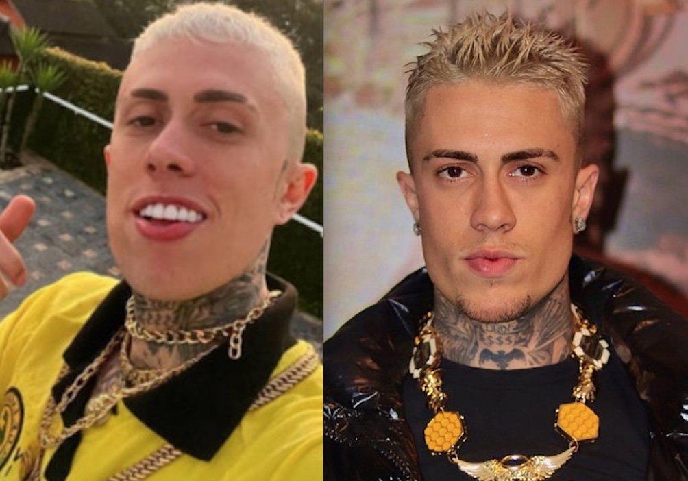 MC Daniel revela harmonização facial e lista procedimentos estéticos