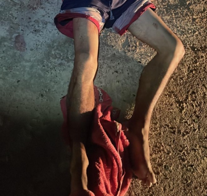 Homem é encontrado morto na avenida Margarita