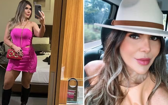 Dona de hotel de luxo morre após cirurgia plástica