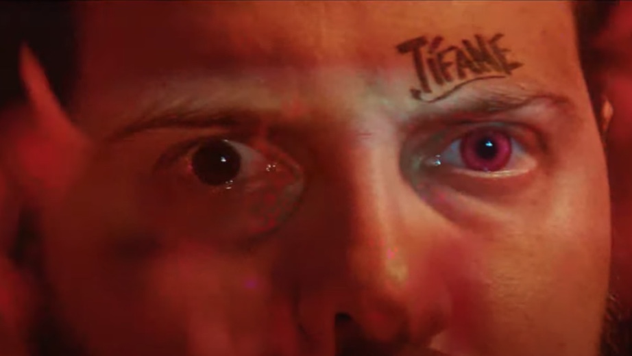 Diogo Defante faz 'chá revelação' de cirurgia no olho; veja como ficou 