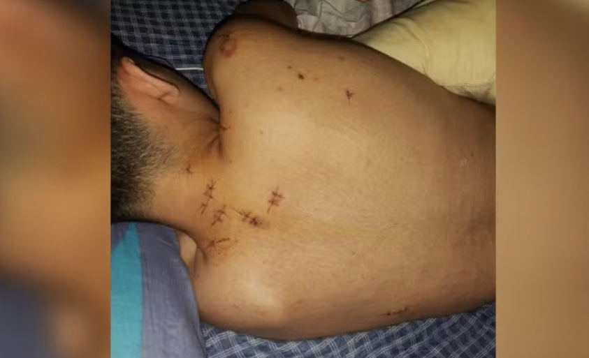 Adolescente é esfaqueado 15 vezes enquanto dormia e obrigado a fazer Pix para assaltante