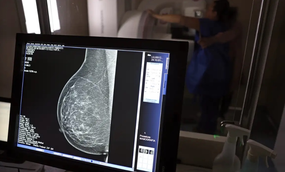 Mais de 77 mil mulheres esperam por mamografia no SUS