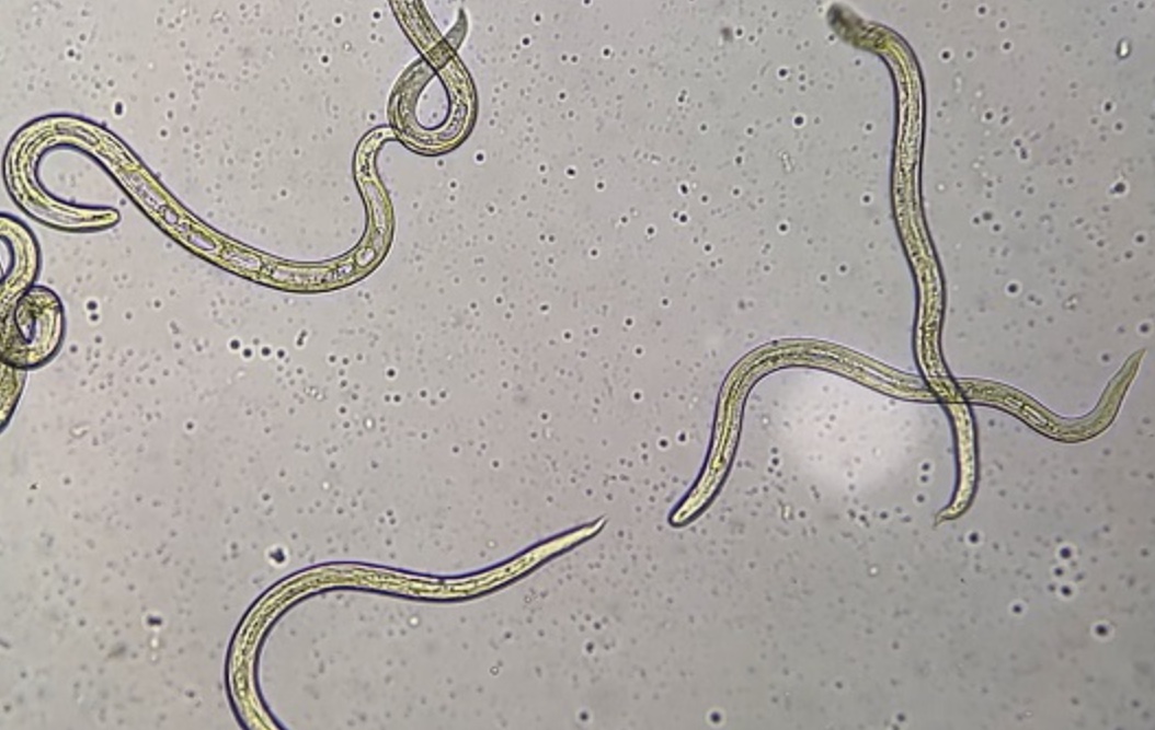 Mulher descobre parasita no cérebro após achar que dor de cabeça era por ‘jet lag’