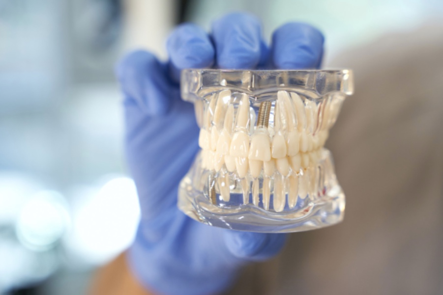 Clínica é condenada por erro em implante dentário em Manaus 
