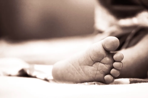 Bebê perde pênis após erro médico