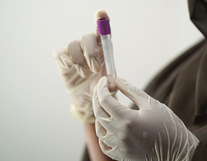 Semsa informa mudança no fluxo para realização de exames laboratoriais em Manaus