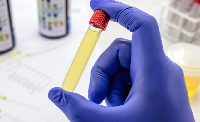 Projeto de Lei em Manaus exige exames toxicológicos para servidores e vereadores