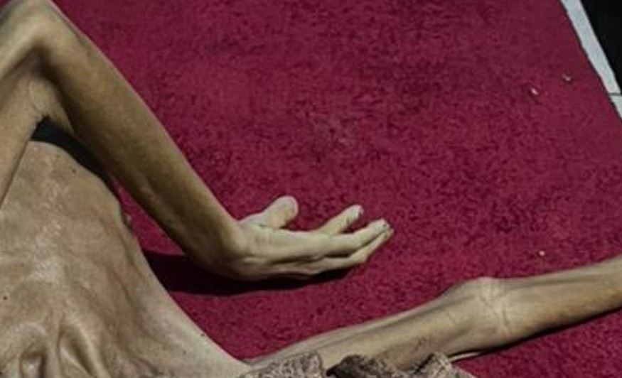 Idoso é encontrado morto em estado de desnutrição extrema no São José