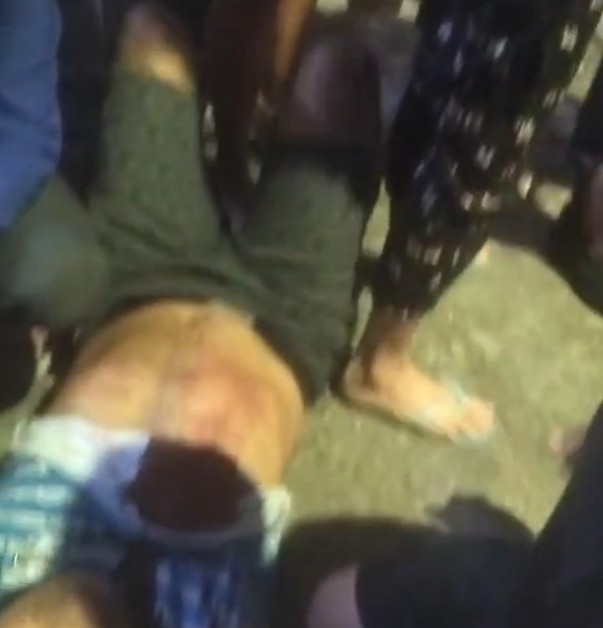 Homem é assaltado e baleado na frente de UBS no bairro da Paz