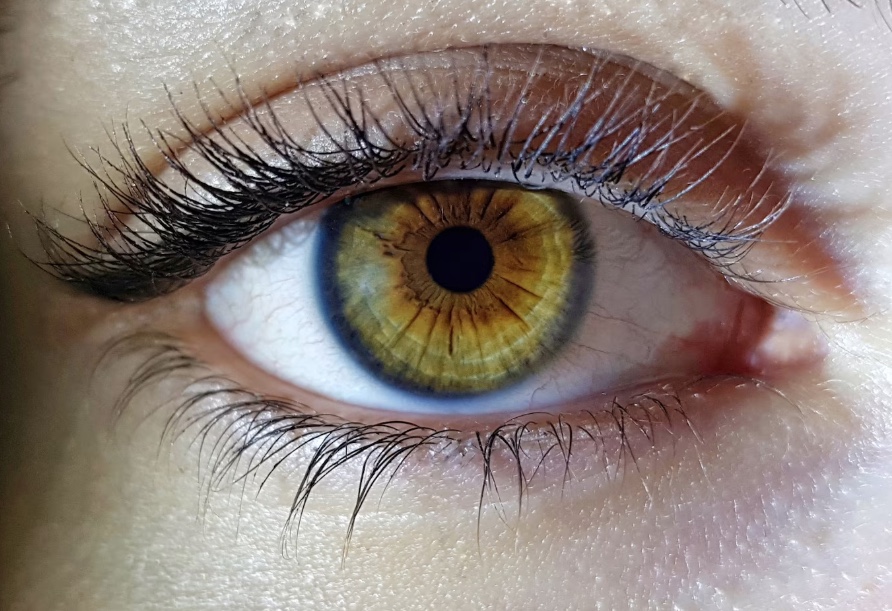 Unimed Manaus é condenada por negar remédio e colocar paciente em risco de cegueira