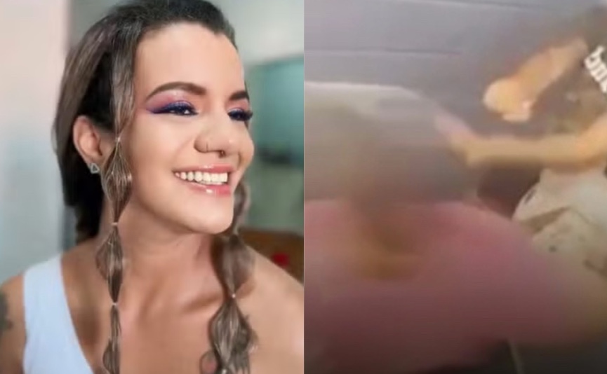 Mulher agredida com 61 socos passou por cirurgia de 7 horas para reconstruir rosto