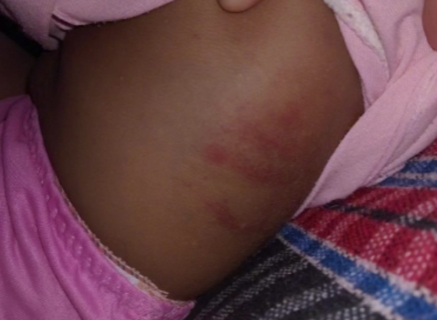 Bebê vai parar no hospital após ser espancada por padrasto em Itacoatiara