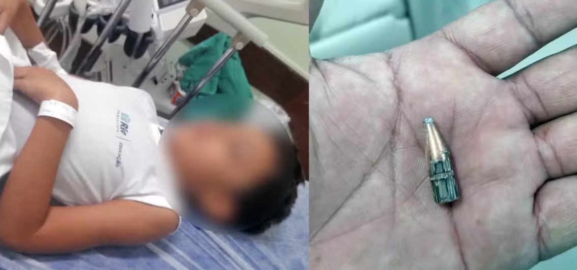 Menino de 7 anos é ferido por bala perdida: "Papai, eu não sou bandido. Por que levei um tiro?"