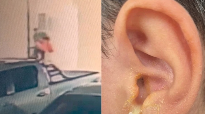 Criança que teve tímpano perfurado por servidor do TJAM sofre traumas e evita sair de casa, relata pai