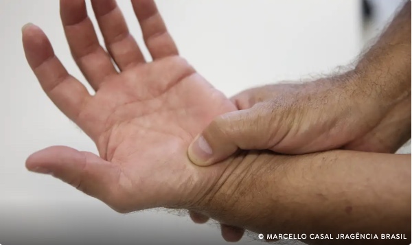 ANS torna obrigatória cobertura de medicamentos para Lúpus por planos de saúde