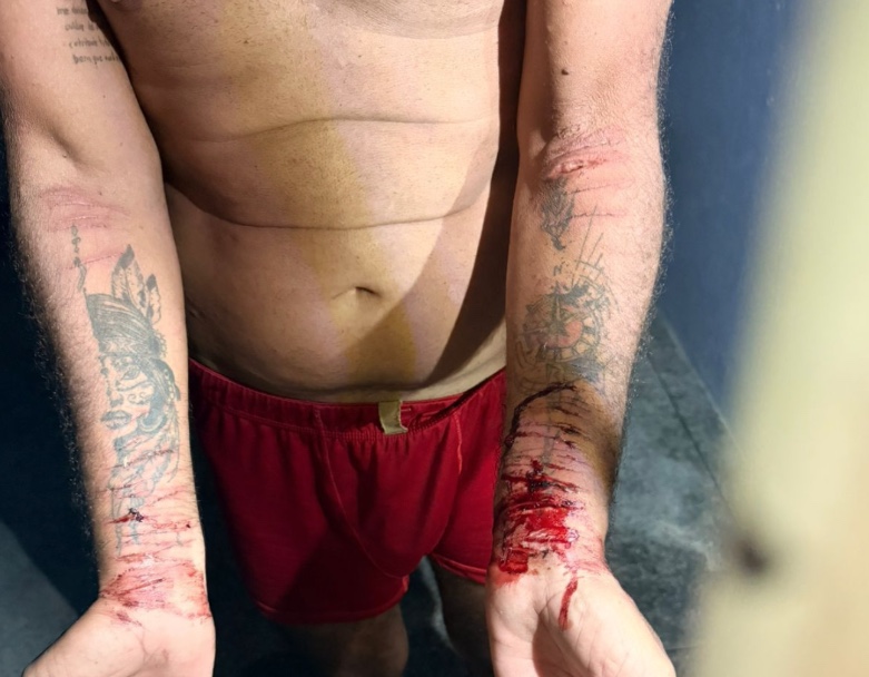 Preso pela morte de filho se automutilou e fingiu ser morador de rua em Manaus