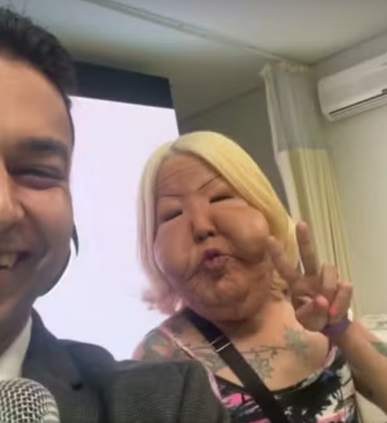 'Juju do Pix' passa por cirurgia para remover óleo que deformou seu rosto; veja antes e depois