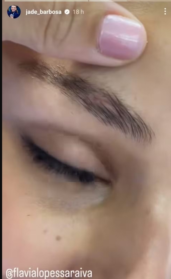 Jade Barbosa mostra a cicatriz de Flavia Saraiva 22 dias depois da queda nas Olimpíadas